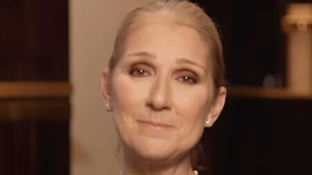 Cos’è la sindrome dell’uomo rigido, la malattia di Celine Dion Celine Dion
