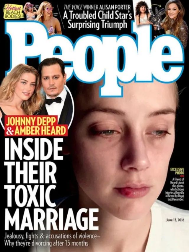 Amber Heard con le ferite al volto, sulla copertina di People