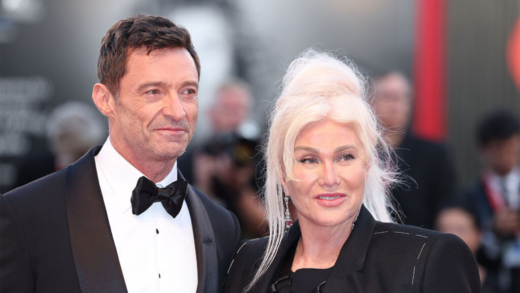 Hugh Jackman, accordo milionario sul divorzio per proteggere i suoi segreti? jackman furness