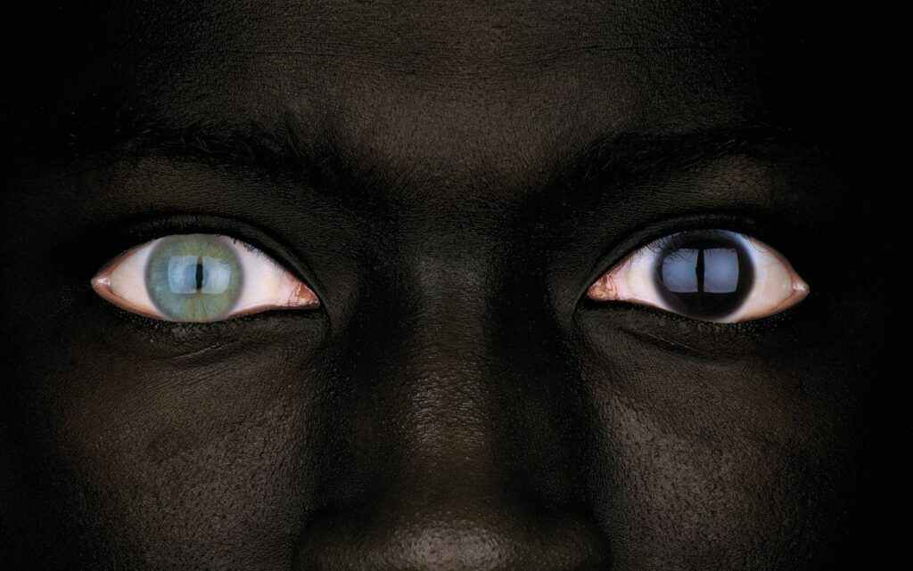 Occhi con eterocromia - foto di Oliviero Toscani