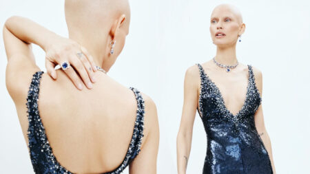 Perché Bianca Balti era senza capelli a Sanremo 2025: “Il potere del mio aspetto” Bianca Balti con uno degli abiti di Sanremo 2025