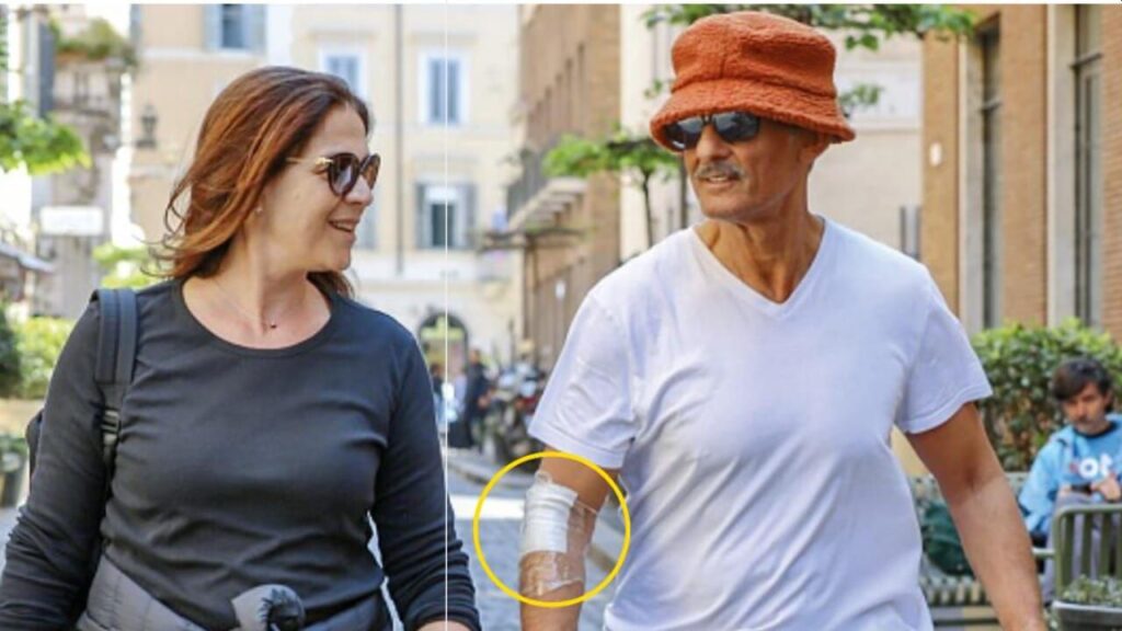 Fiorello si è operato al braccio? Lui fa chiarezza sul bendaggio Fiorello con il braccio bendato