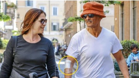 Fiorello con il braccio bendato