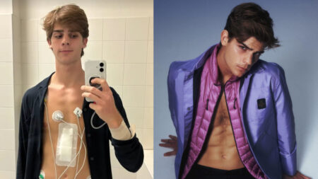 Leonardo Tano operato