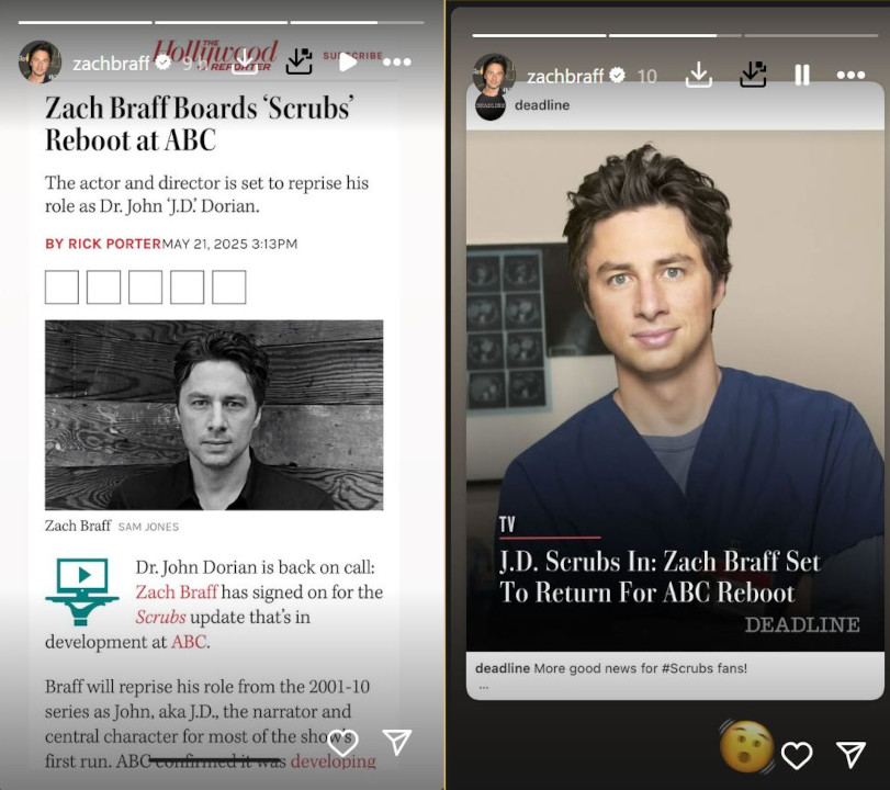 Le stories di Zach Braff su Scrubs