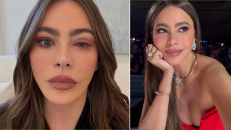 Sofia Vergara con l'occhio gonfio