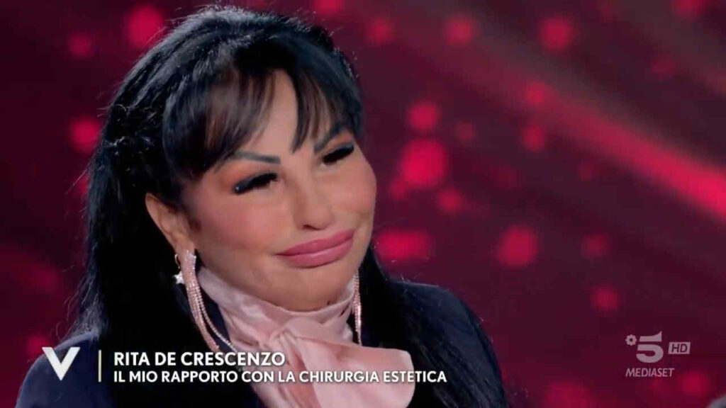 Rita De Crescenzo prima e dopo la chirurgia estetica: la foto del cambiamento lascia senza parole Rita De Crescenzo a Verissimo