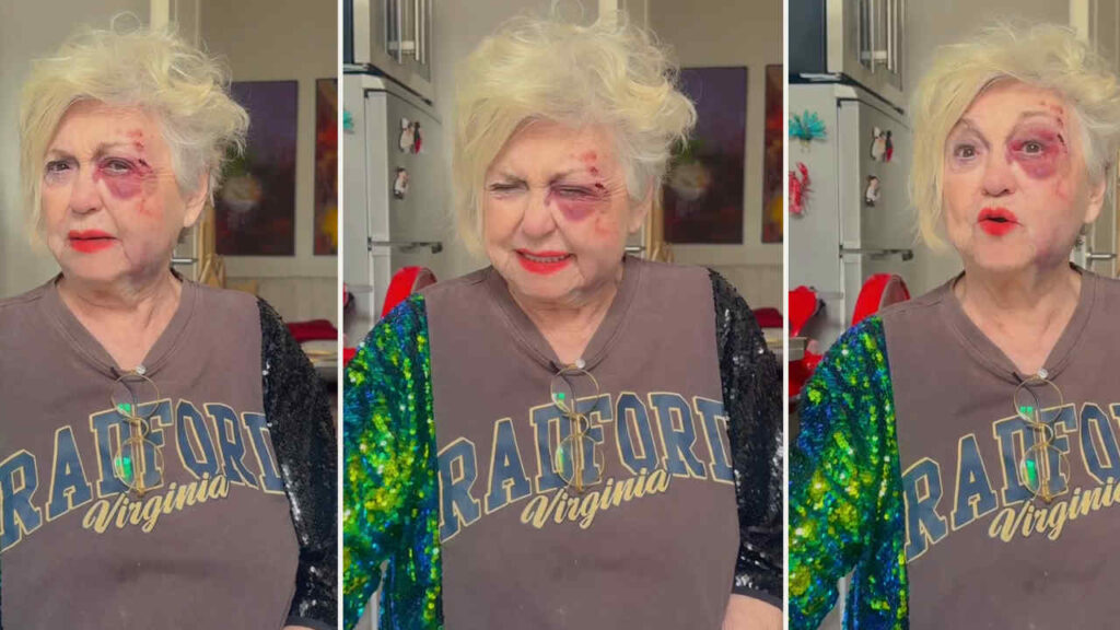 Wanna Marchi dopo l'incidente