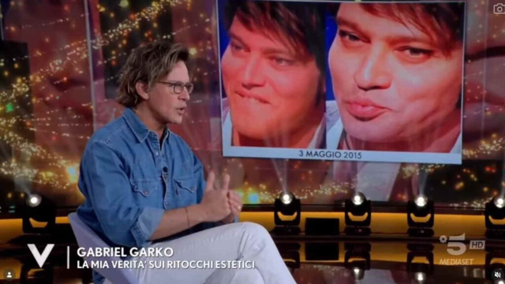 Gabriel Garko parla di ritocchi estetici a Verissimo