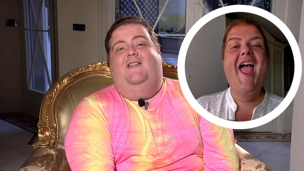 Da 200 a 118 kg: la svolta di Francesco Nozzolino e la confessione sui prossimi interventi estetici Francesco Nozzolino prima e dopo