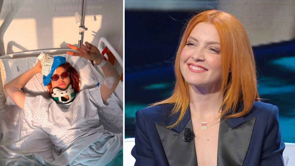 Noemi, cosa si è fatta dopo la caduta dal palco: parla il primario Noemi ricoverata